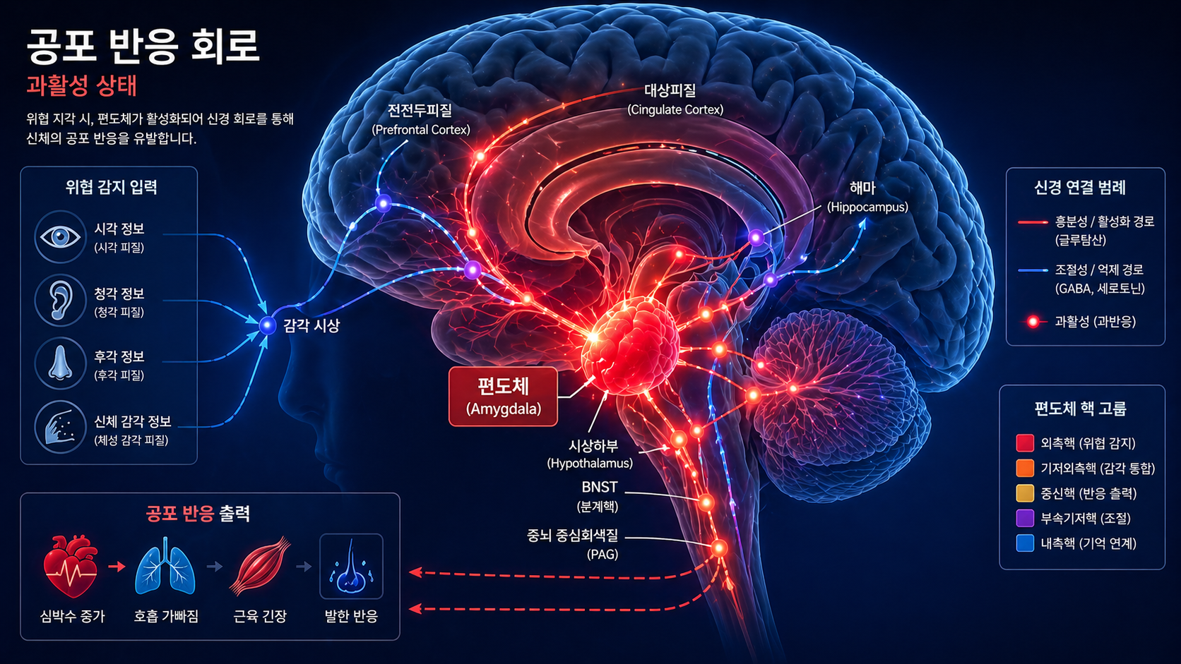 공황장애 신경계 편도체 과활성 이미지